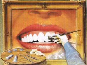 Реставрация зубов в Вологде