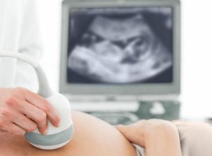 УЗИ при беременности – ответы на главные вопросы будущей мамы