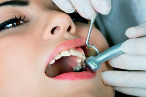 Лечение пародонтоза зубов. Записывайтесь!