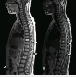Магнитно-резонансная томография (МРТ) спины в Оренбурге