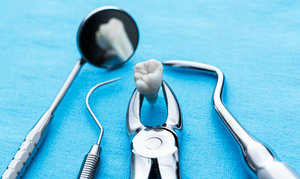 Хирургическая стоматология в Череповце