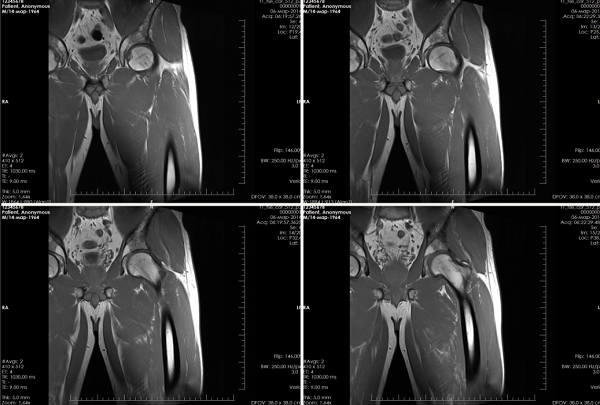 МРТ бедра в кабинете МРТ в Оренбурге