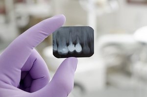 Рентген зубов в Череповце