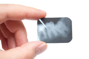 Где можно сделать рентген зуба в Вологде?