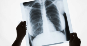 Узнайте больше о состоянии своих лёгких с компьютерной томографией в "Кабинете МРТ" в Оренбурге!